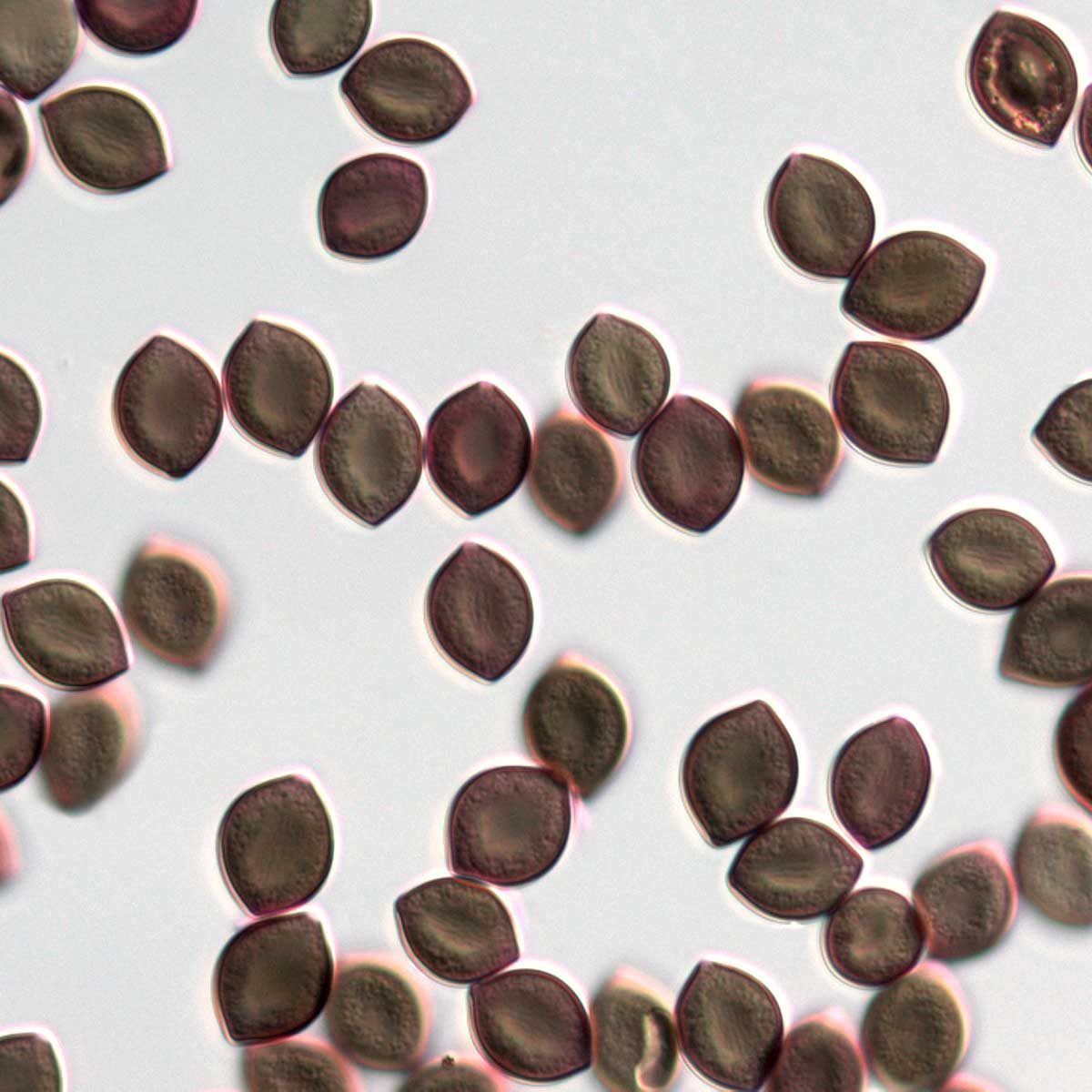 What to Know About Chaetomium Mold